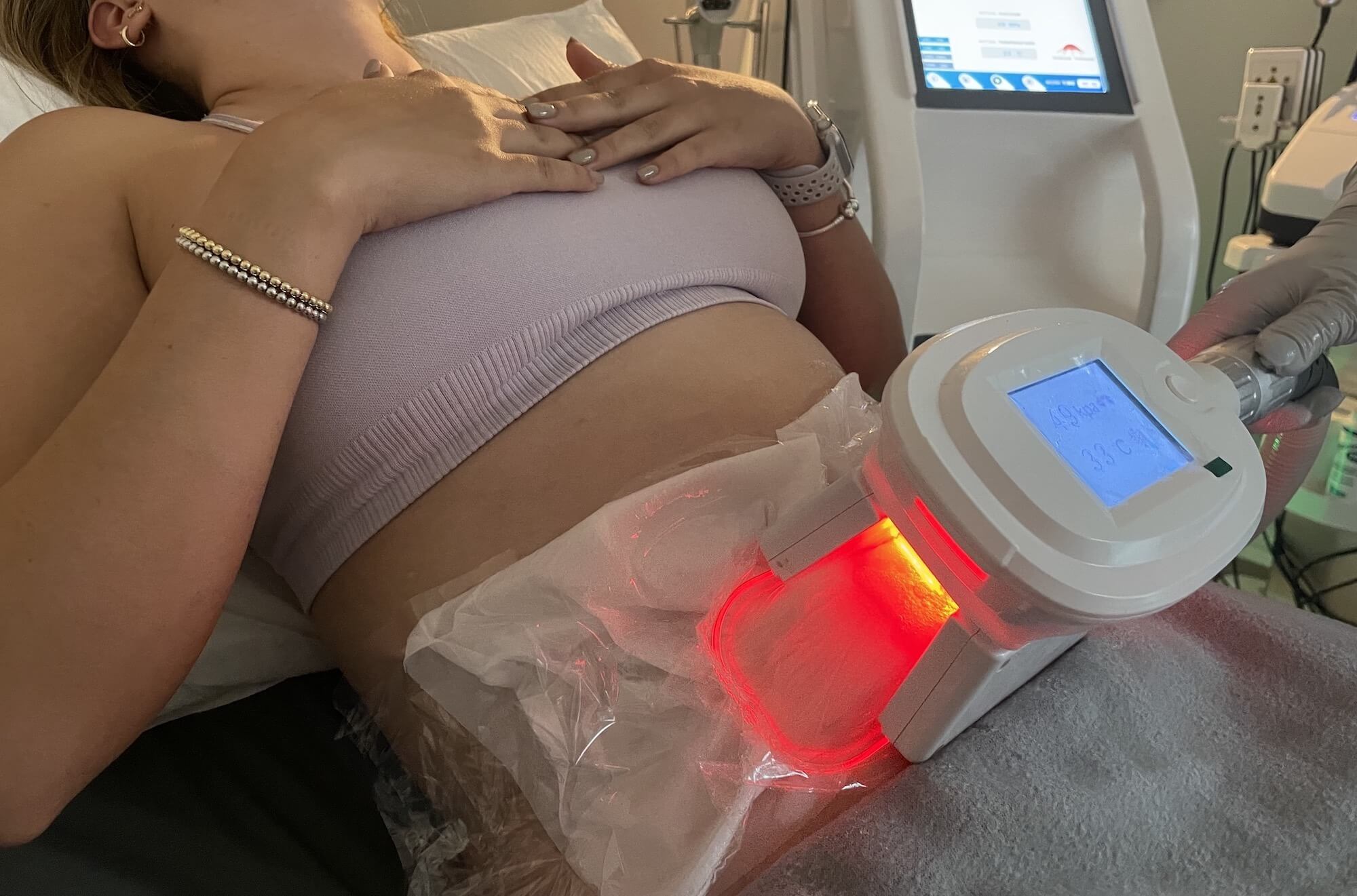 Cryolipolysis