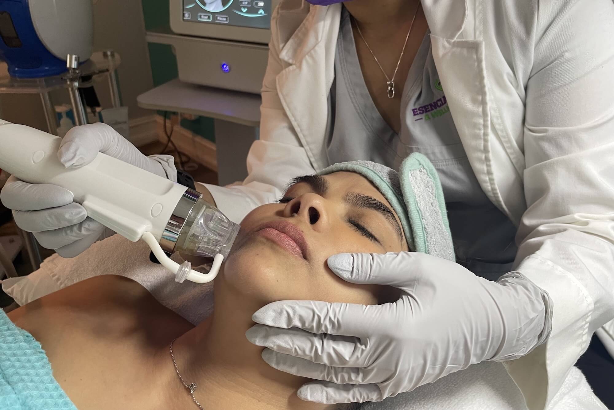 RF Microneedling