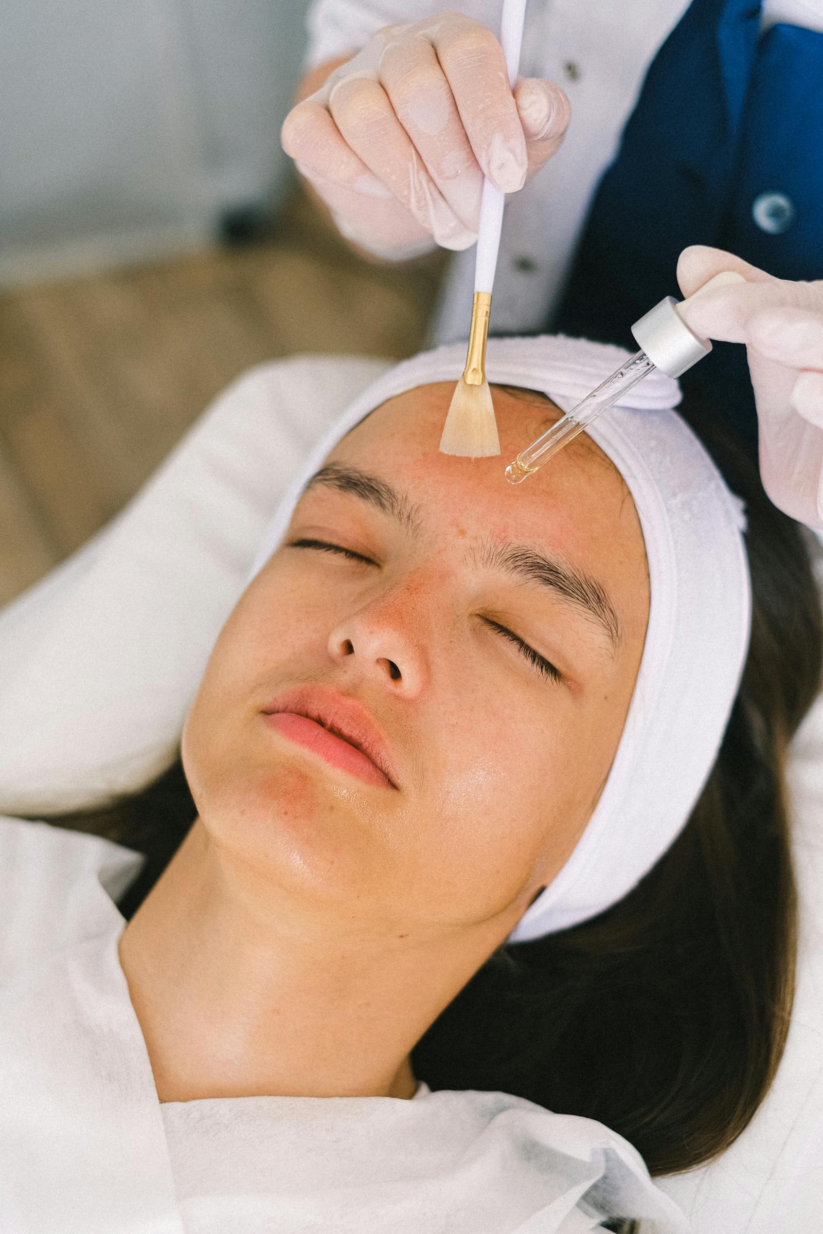Chemical Peels Facial